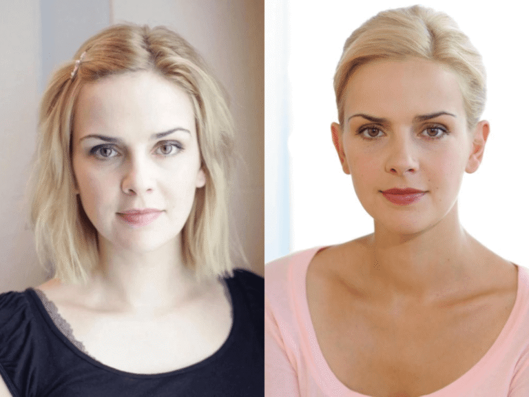 denise zich krankhelt