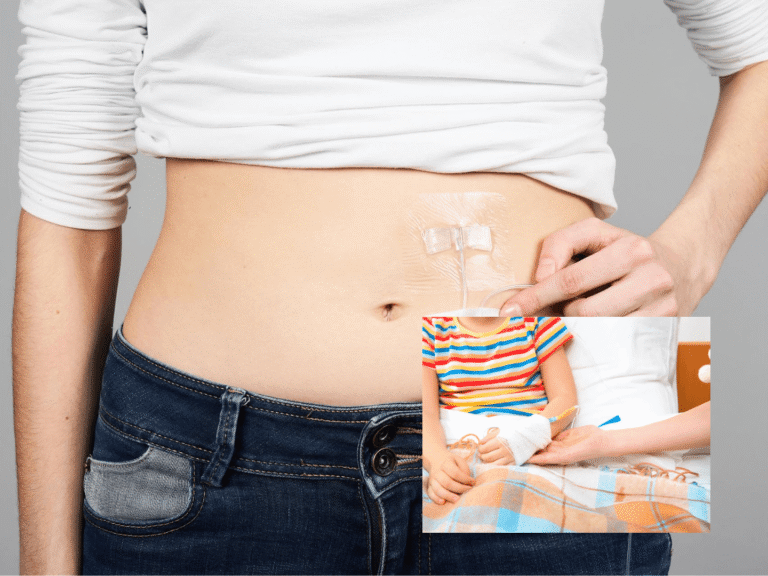 morbus gaucher therapie