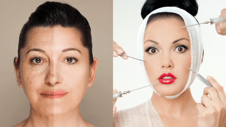 botox spätfolgen